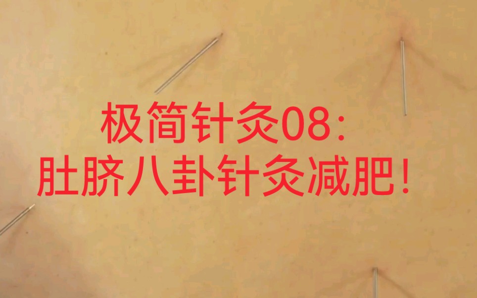 肚子上针灸的功效(肚子上针灸：缓解胃痛、促进消化的好方法) ...